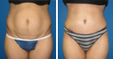 Before & After Photos